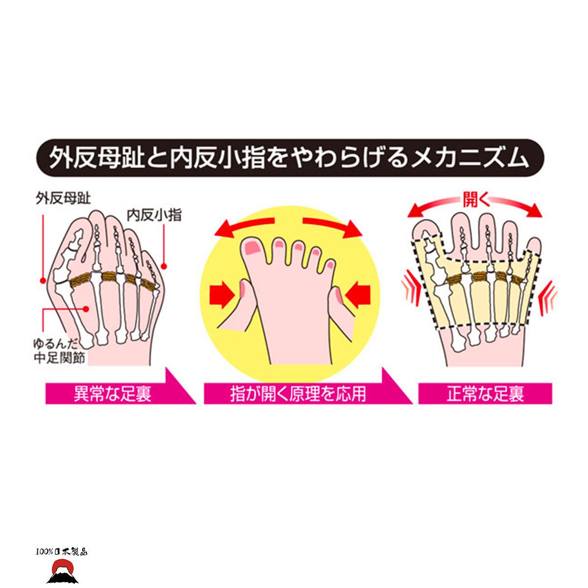 日本製ALPHAX 右腳拇趾外翻和尾趾內翻支撐套 M碼 右腳適用 - PLATEAUX LoHas Japan